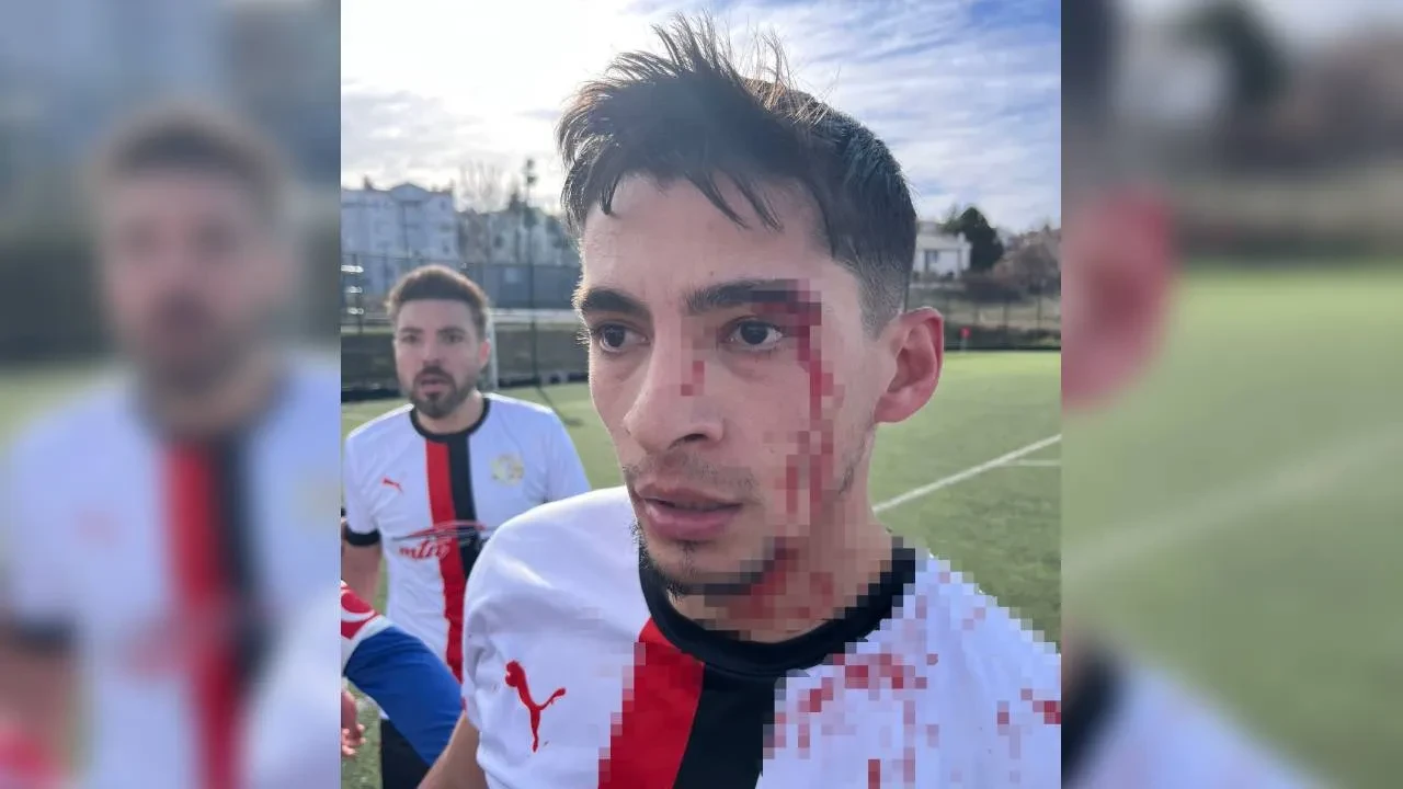 /spor/futbol-maci-savas-alanina-dondu-futbolcular-hastanelik-oldu-3283682