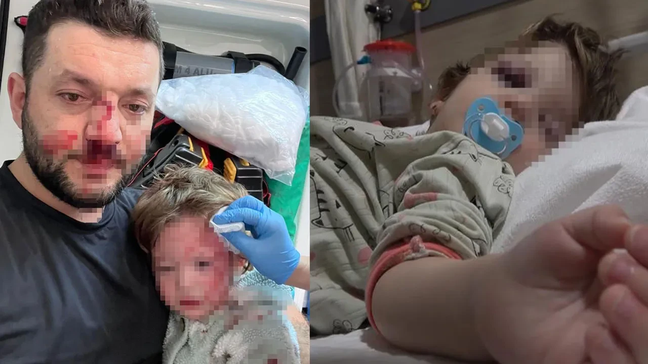 Yalova’da "gürültü" vahşeti! Kucağındaki bebeğiyle saldırıya uğrayan babanın burnu kırıldı, 14 aylık İkra’nın kafatası çatladı