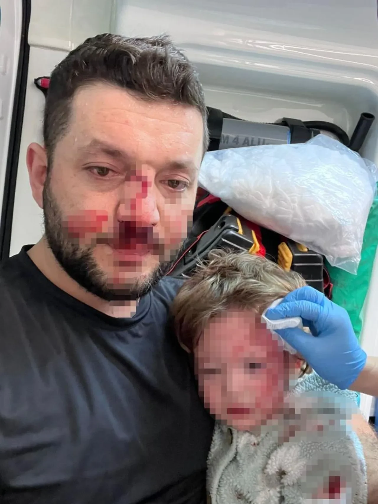 Yalova’da "gürültü" vahşeti! Kucağındaki bebeğiyle saldırıya uğrayan babanın burnu kırıldı, 14 aylık İkra’nın kafatası çatladı: Bakan Gürlek'ten açıklama geldi