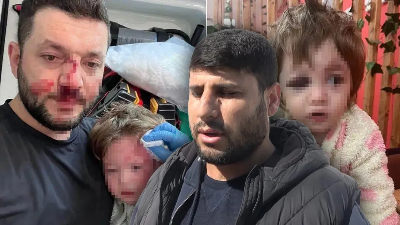 Baba ve 14 aylık bebeği acımasızca darbedildi! İddiaların odağındaki komşu konuştu: Bilerek bir şey yapmadık