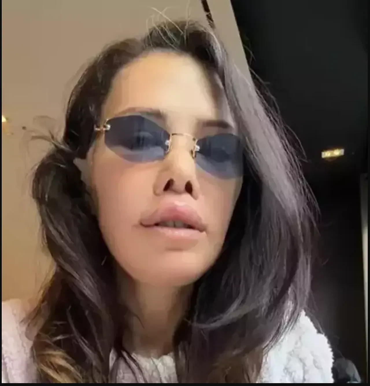 Yüz nakli ameliyatı olan Didem Ceran, günler sonra son halini paylaştı