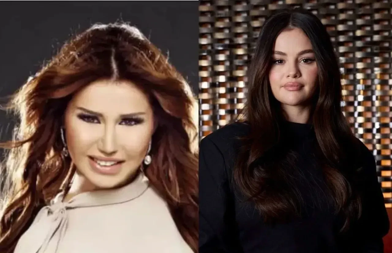 Ceylan estetiğe tövbe etti! Nedeni herkesi şaşırttı 