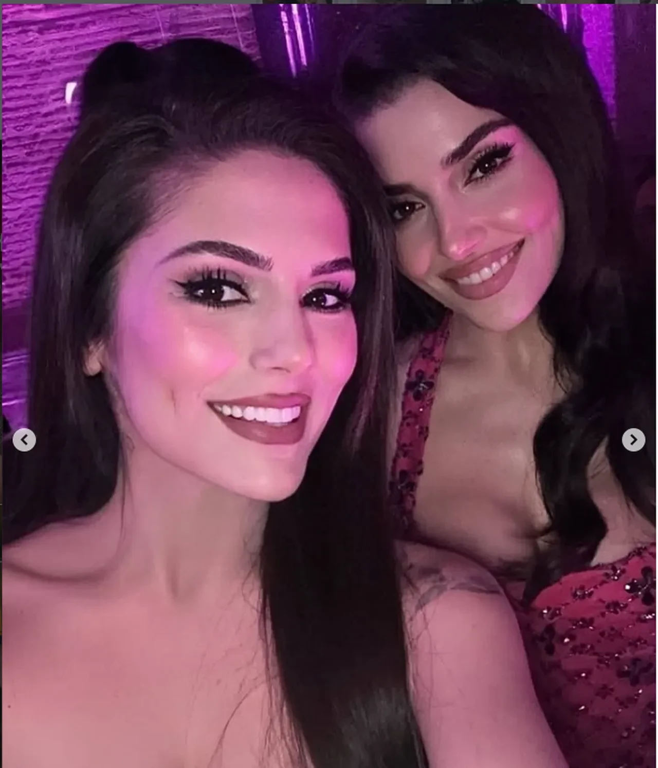 Kısmetse Olur Aybüke Çangal Hande Erçel'e benzemek için bir dizi ameliyat oldu! Son hali "pes" dedirtti