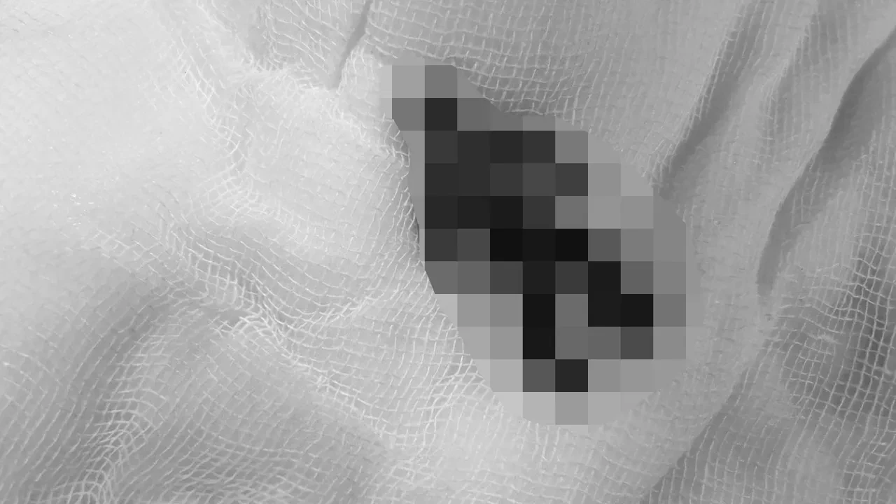 Hindistan'da çocuğun midesinden çıkanlar doktorları şoke etti! Mideye nasıl indiğini kimse bilmiyor