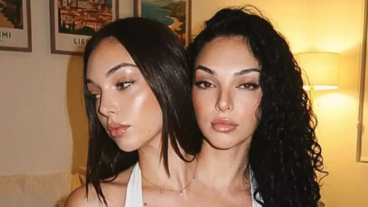 Sosyal medya fenomeni "yapışık ikizler" hakkında ortalığı karıştıran iddia: Hepsi birer yapay zeka ürünü