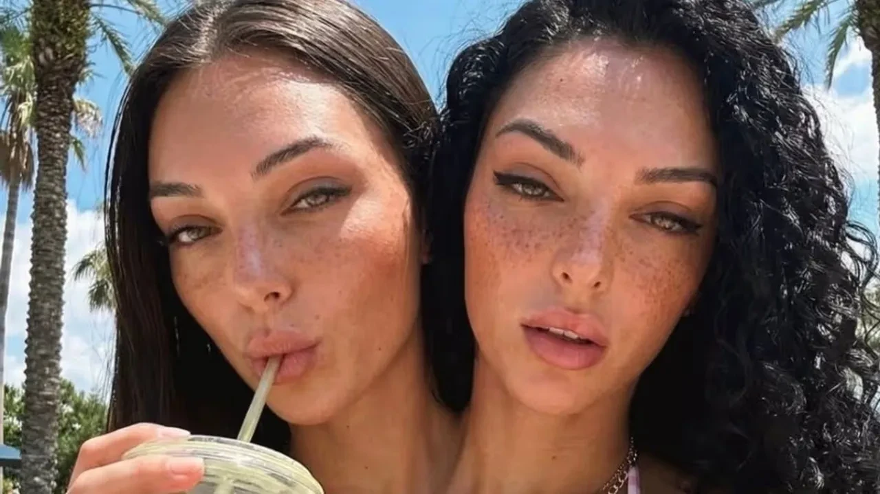 Sosyal medya fenomeni "yapışık ikizler" hakkında ortalığı karıştıran iddia: Hepsi birer yapay zeka ürünü