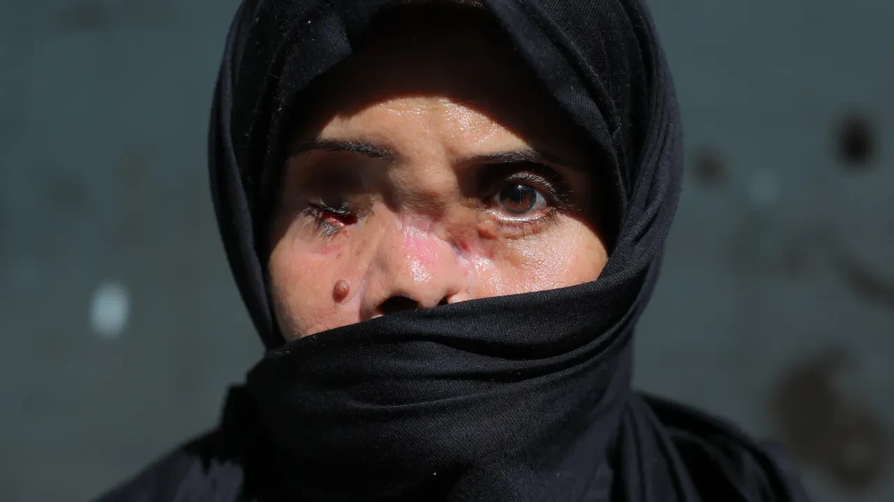 Öldü sanıldı, kefene koyuldu: Ağır yaralanan genç kadın her şeye rağmen hayata tutundu