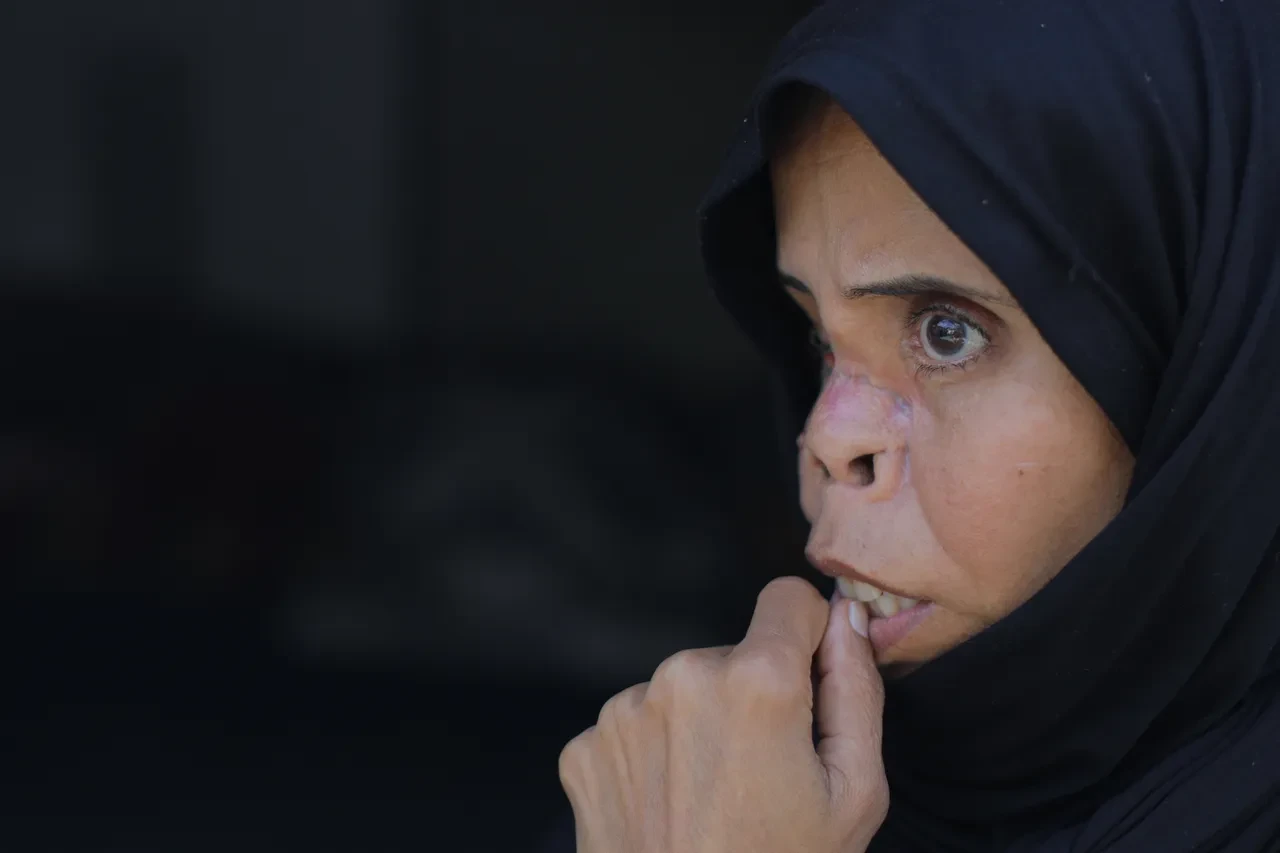 Öldü sanıldı, kefene koyuldu: Ağır yaralanan genç kadın her şeye rağmen hayata tutundu