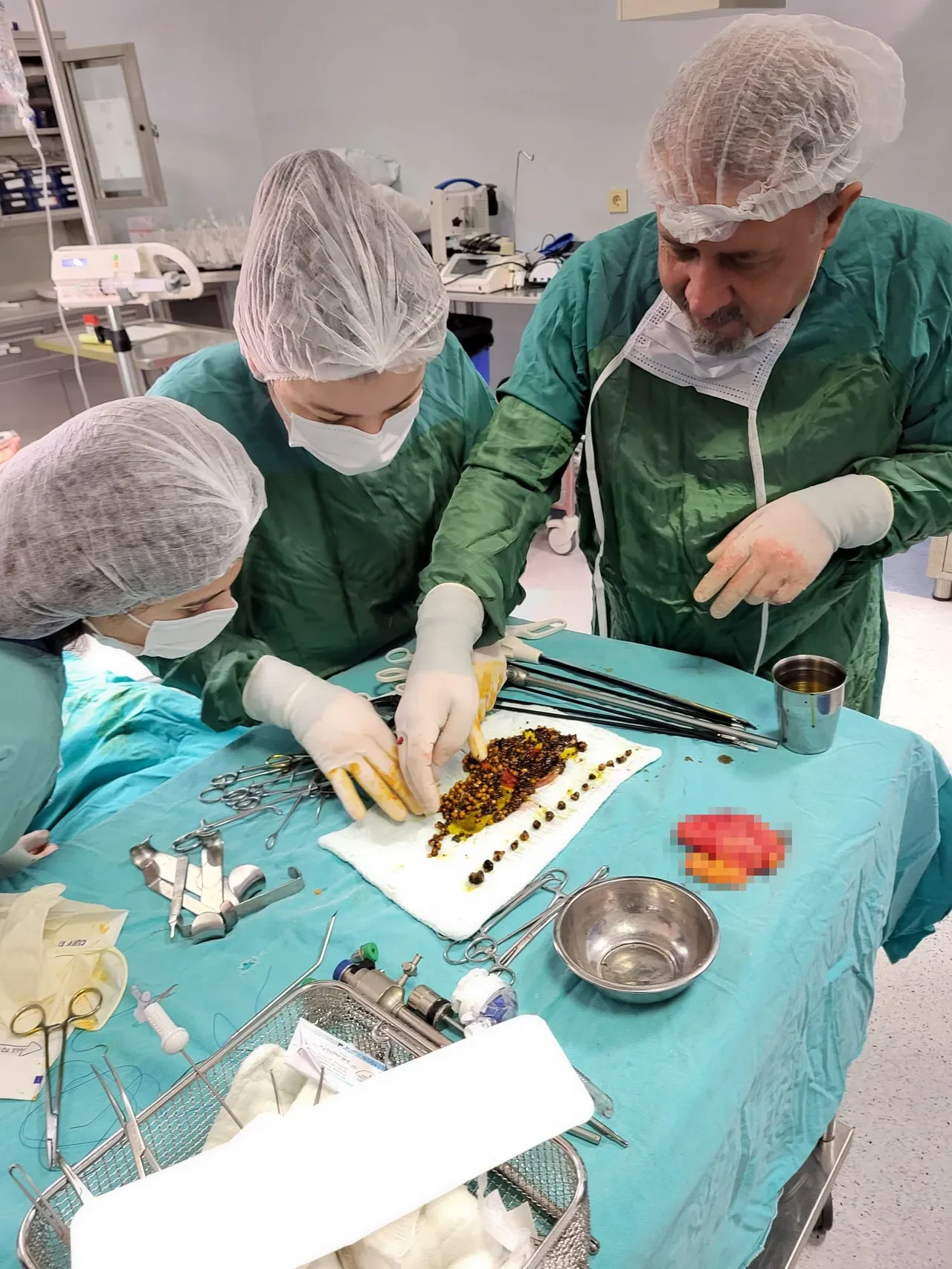 Karın ağrısıyla gitti, vücudundan çıkanlar hayrete düşürdü: 'Taş ocağı gibiydi'