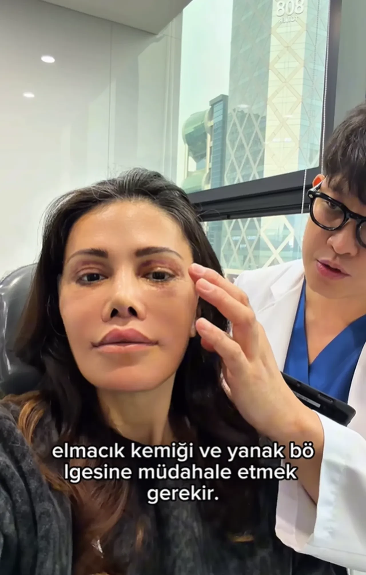 Survivor yarışmasıyla tanınan Didem Ceran, “Yüz naklimin 17. günü" diyerek son halini paylaştı 