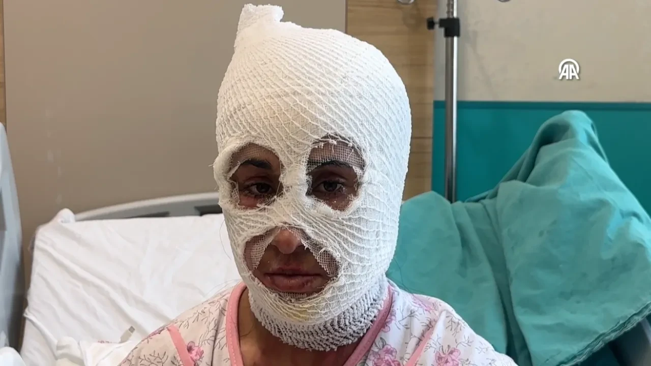 İftar hazırlığı faciaya dönüştü: Düdüklü tencere genç kadını yaktı