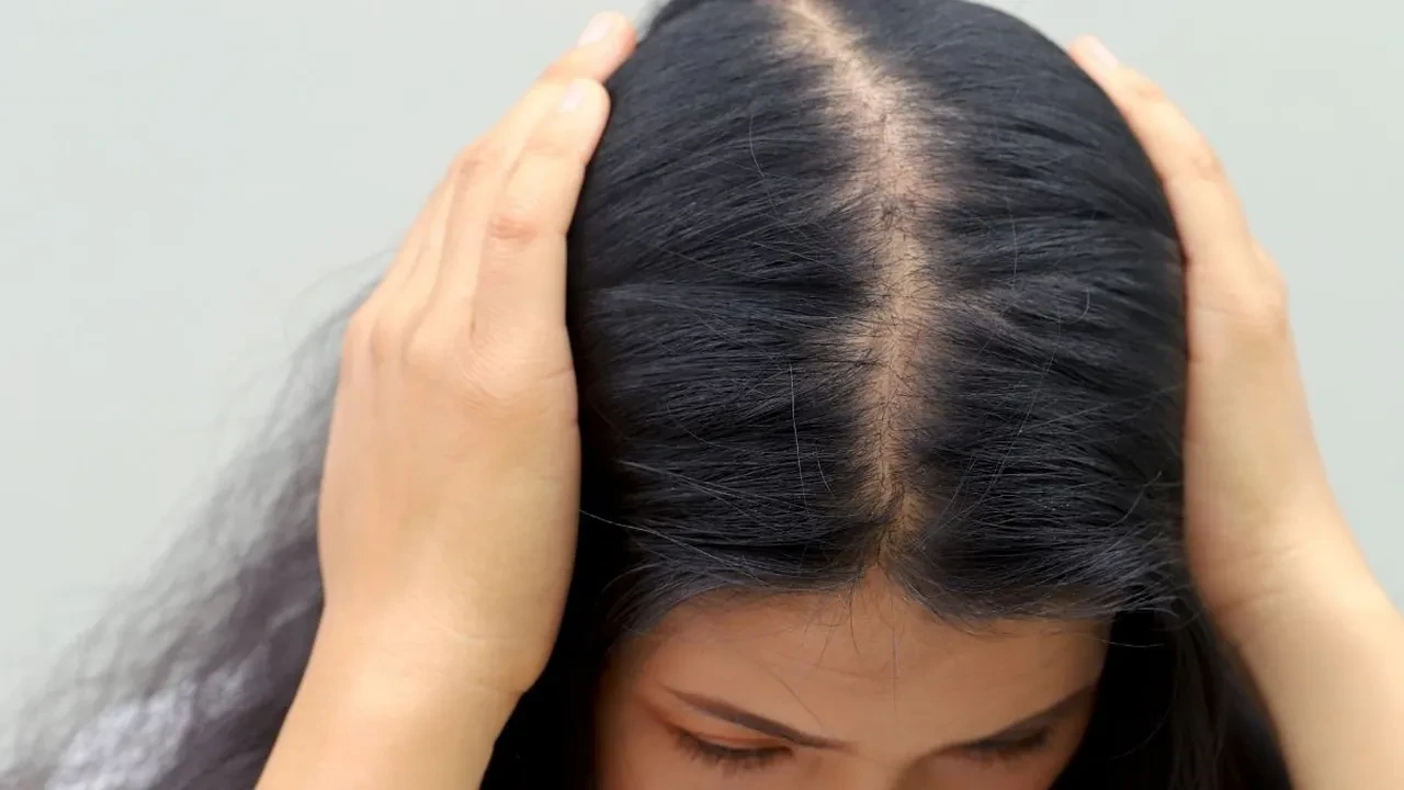 Saç köklerini güçlendiriyor! Koparak dökülmelere iyi gelen doğal karışım