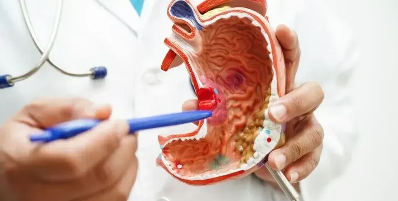 Uzmanı uyardı: "Dünyada her dakika 3 kişi kronik böbrek hastalığı nedeniyle hayatını kaybediyor"