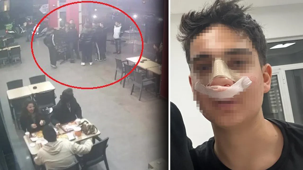 Antalya'da akran dehşeti! Hiç tanımadıkları çocuğu dövüp burnunu kırdılar: O anlar kamerada