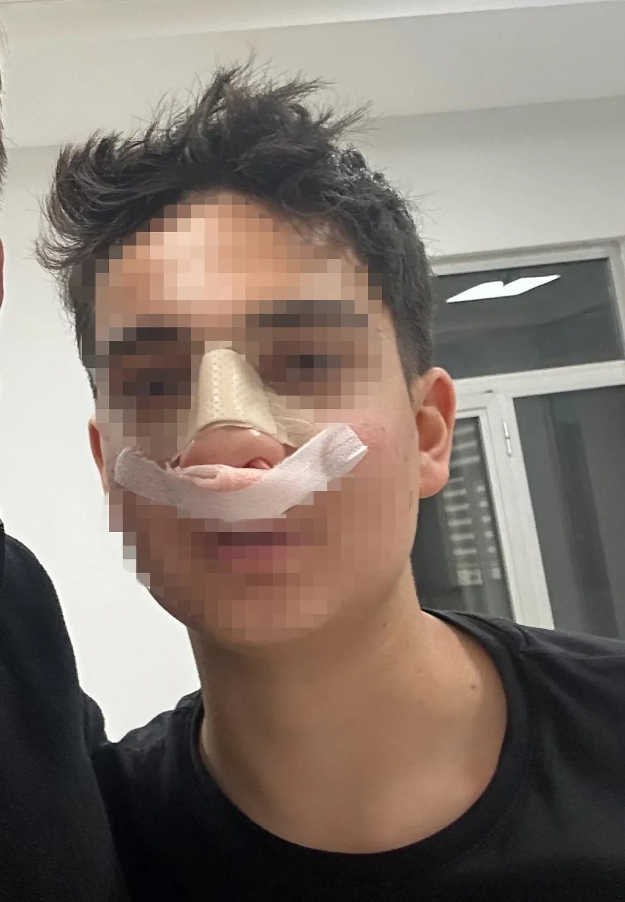 Antalya'da akran dehşeti! Hiç tanımadıkları çocuğu dövüp burnunu kırdılar: O anlar kamerada 