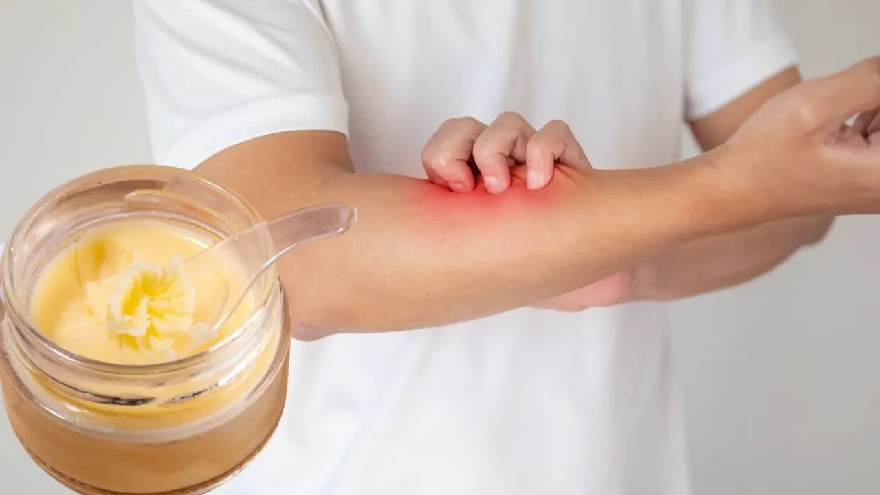 Egzamaya doğal krem çözümü! Asırlık sır yumuşacık cilt