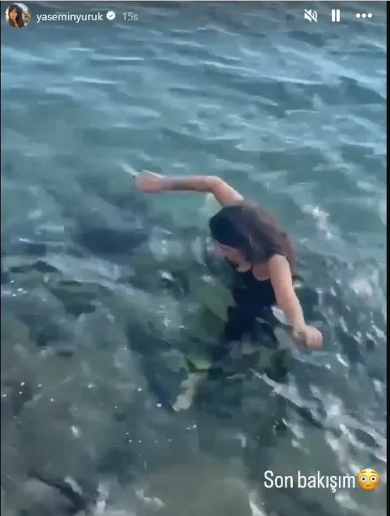 'Hepsi' grubu eski üyesi Yasemin Yürük, sokakta yürüdüğü sırada talihsiz bir kaza geçirdi