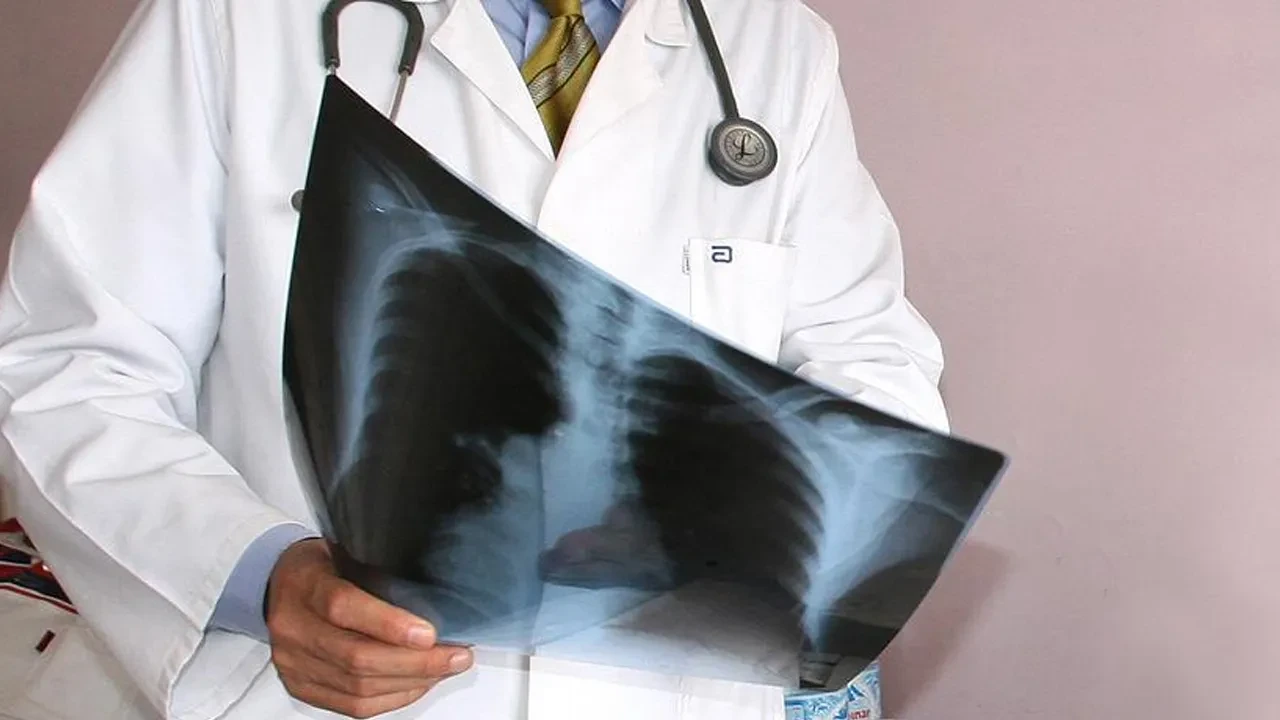 Yüz kişiden 1'inde görülüyor! Uzman isimden kritik uyarı: 