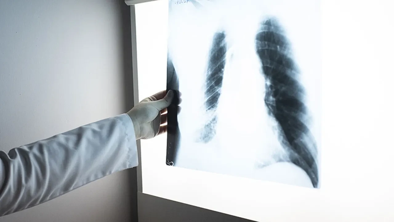 Yüz kişiden 1'inde görülüyor! Uzman isimden kritik uyarı: "Yüksek ölüm oranı olan bir hastalık"