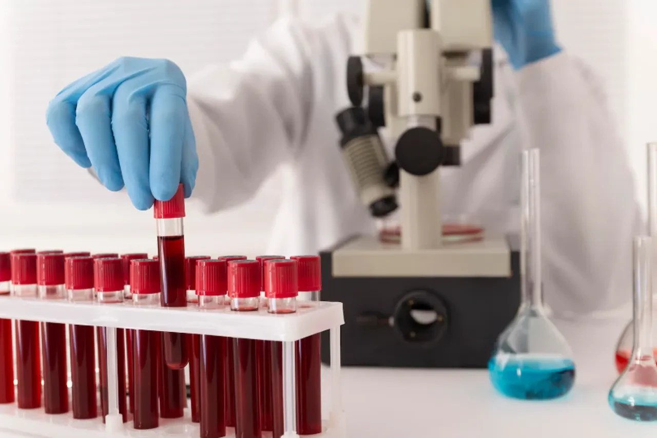 Egzama, saç dökülmesi ve bölgesel kilo sorunu! Hemen kan testi yaptırın