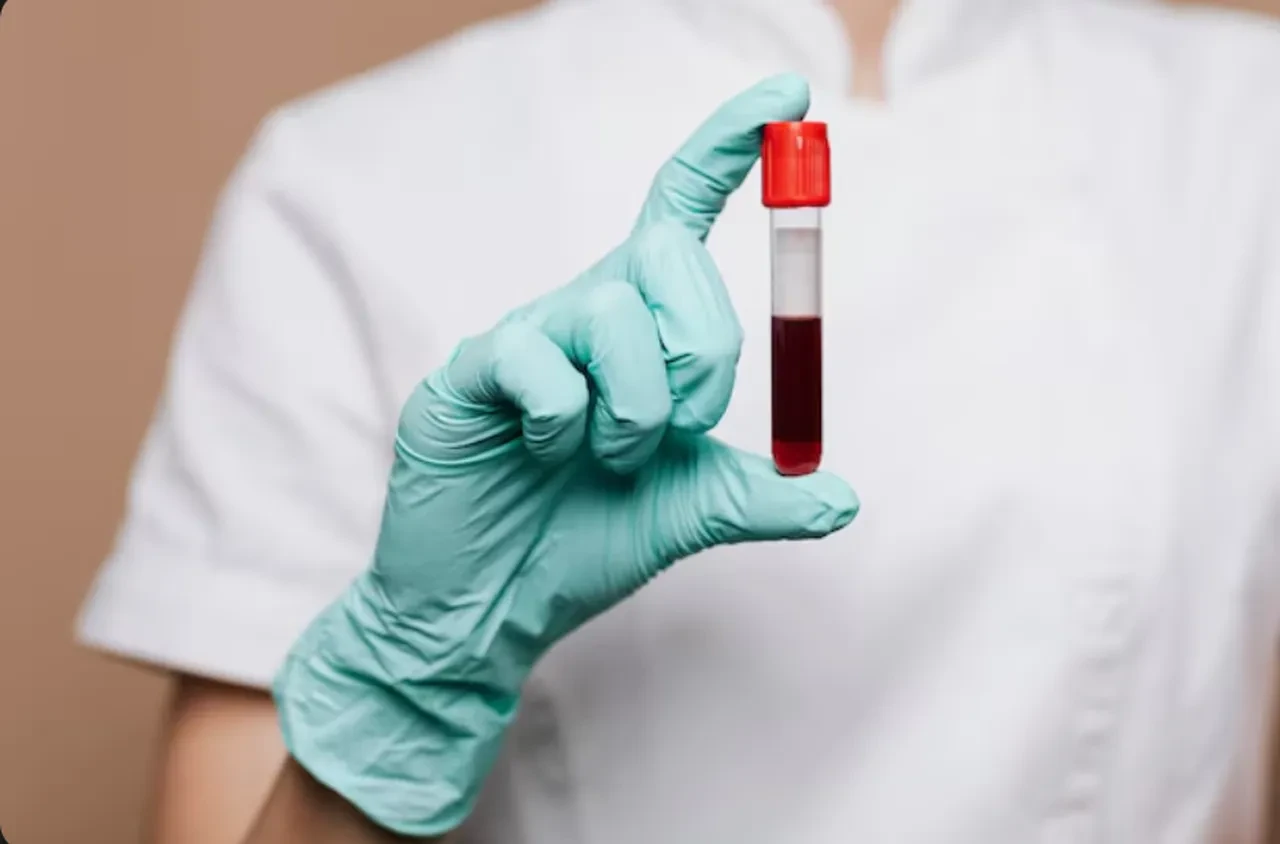 Egzama, saç dökülmesi ve bölgesel kilo sorunu! Hemen kan testi yaptırın