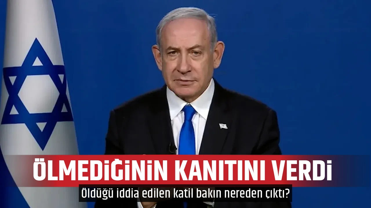 ÖLMEDİĞİNİN KANITINI VERDİ 