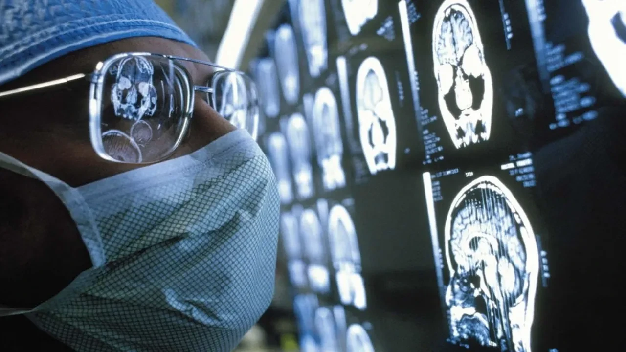 Yüzde 90 doğruluk payıyla beyin tümörünü teşhis eden kan testi geliştirildi
