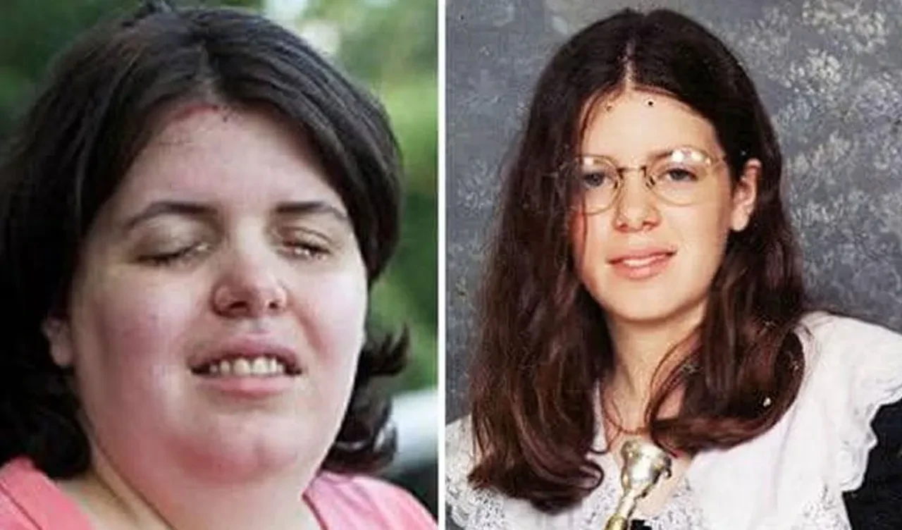 Takıntı, aşk, vahşet! Lavabo açıcıyı gözüne enjekte etti