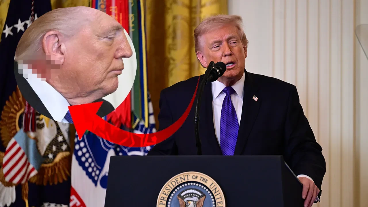 Dünya bu görüntüyü konuşuyor! Donald Trump'ın boynundaki yara dikkat çekti