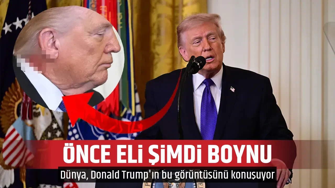 ÖNCE ELİ ŞİMDİ BOYNU