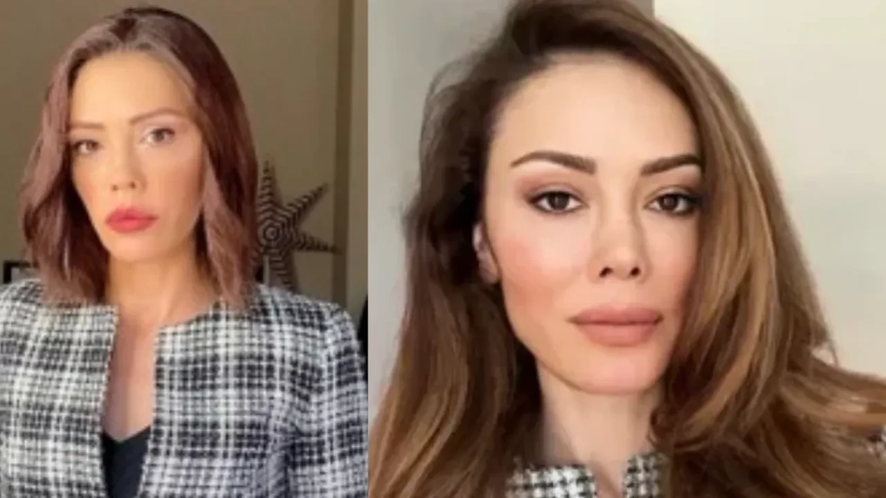 Yüz nakli olan Didem Ceran bandajlarını çıkardı, yeni görüntüsünü takipçileriyle paylaştı 