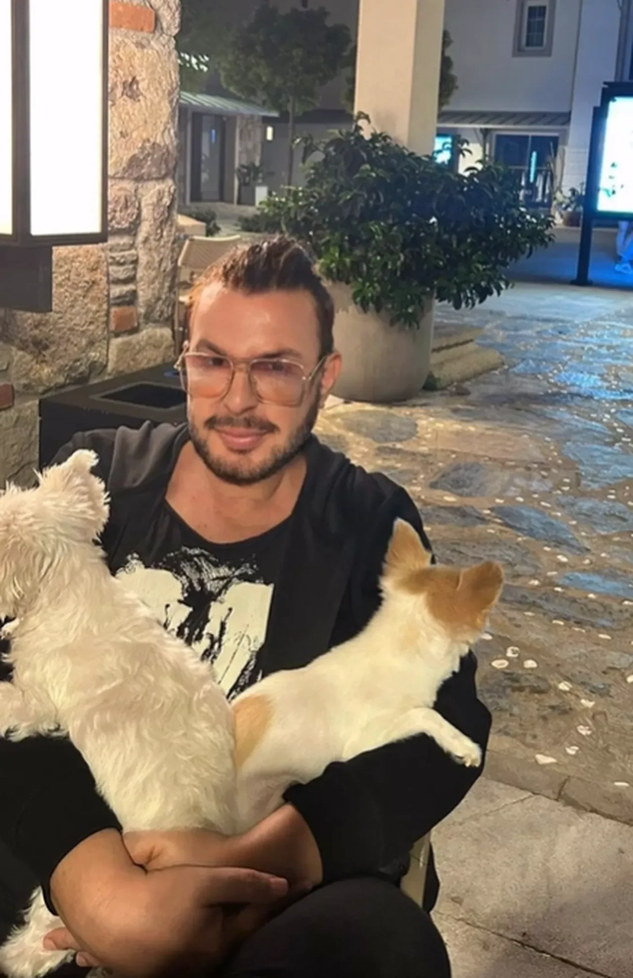 Kuşum Aydın yüzündeki dolgulardan kurtulmak için ameliyat oldu! İşlem öncesi son hali çok konuşuldu 