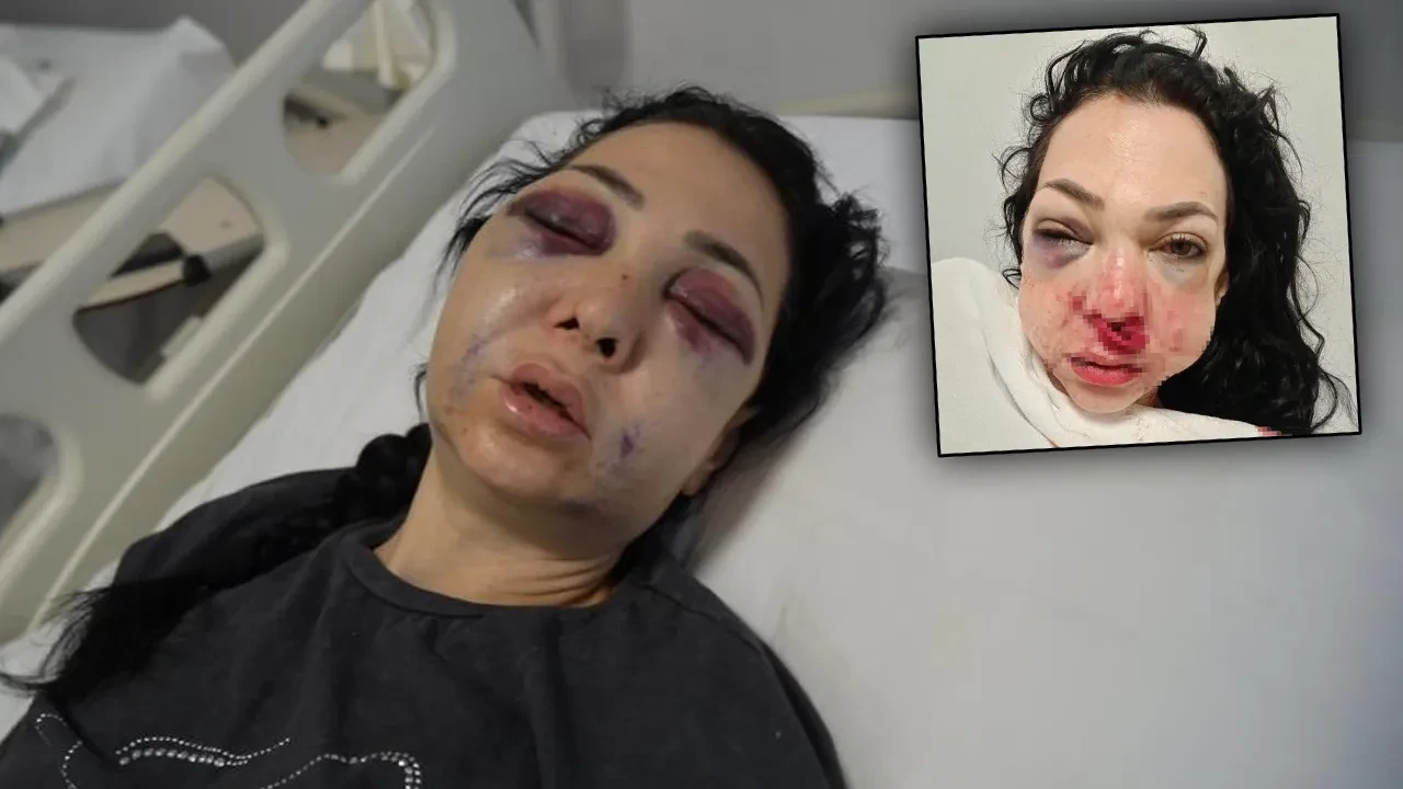 Oğlunun gözü önünde feci şekilde darbedildi: Genç kadın yaşadığı dehşeti anlattı: İnsan olan yapamaz bunu