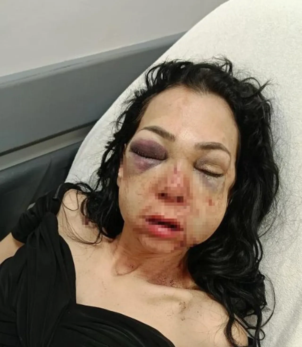 Oğlunun gözü önünde feci şekilde darbedildi: Genç kadın yaşadığı dehşeti anlattı: İnsan olan yapamaz bunu