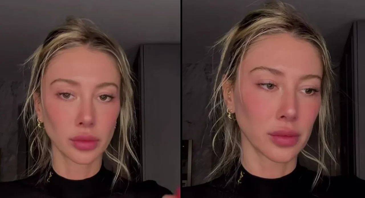 Şeyma Subaşı'nın son paylaşımı gündem oldu! Yüzündeki değişim konuşuluyor