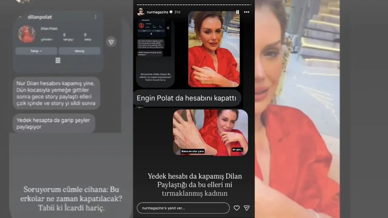 Dilan Polat’ın ellerindeki çizikler dikkat çekti! Engin Polat ile boşanacakları iddiaları yeniden gündeme geldi