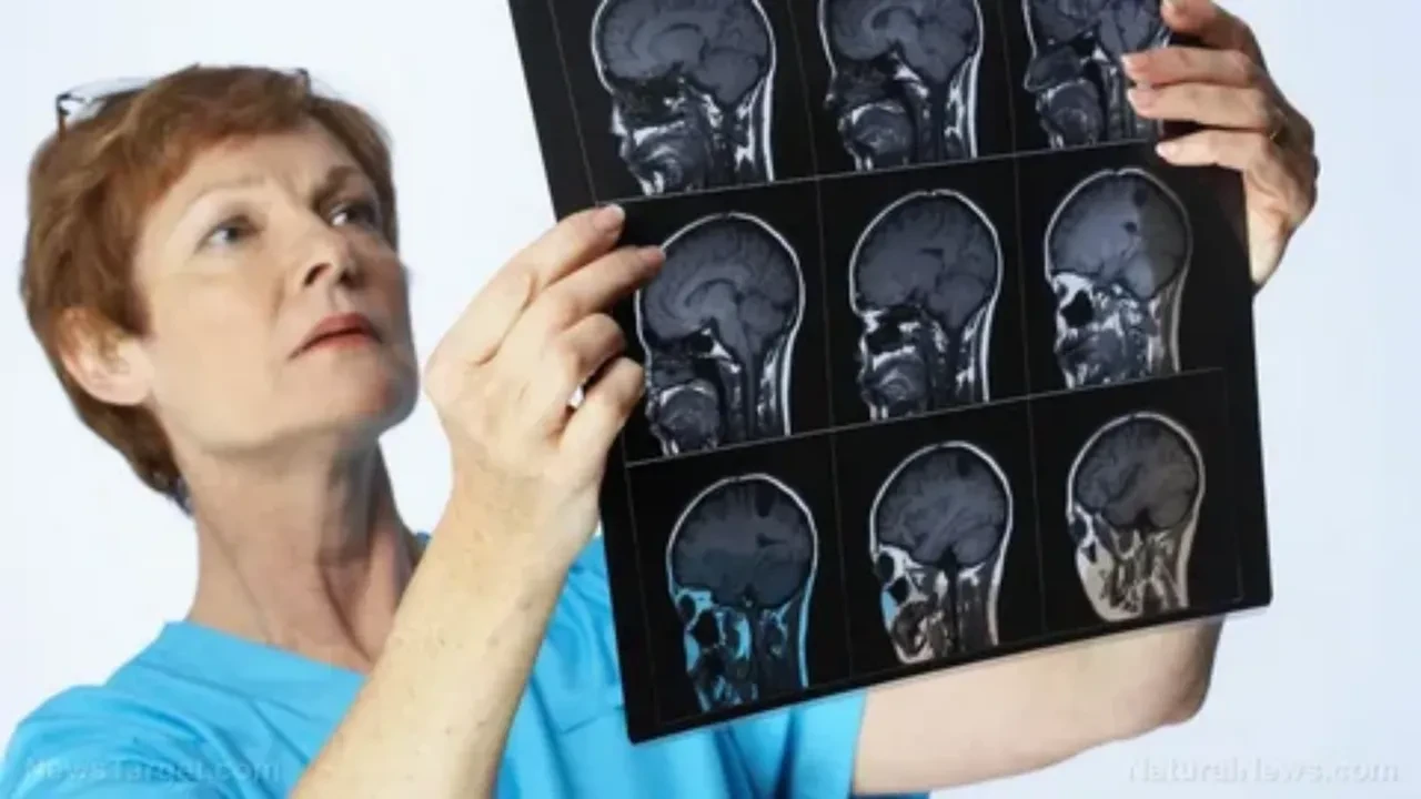 menenjit B belirtileri