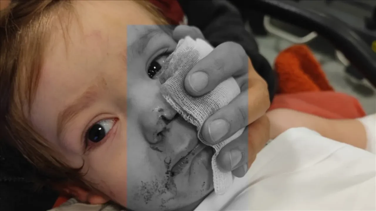 Etimesgut’ta iki çocuğu yaralayan Pitbull’un sahibi hakim karşısına çıkıyor! İddianame hazır: 7,5 yıl hapsi isteniyor 