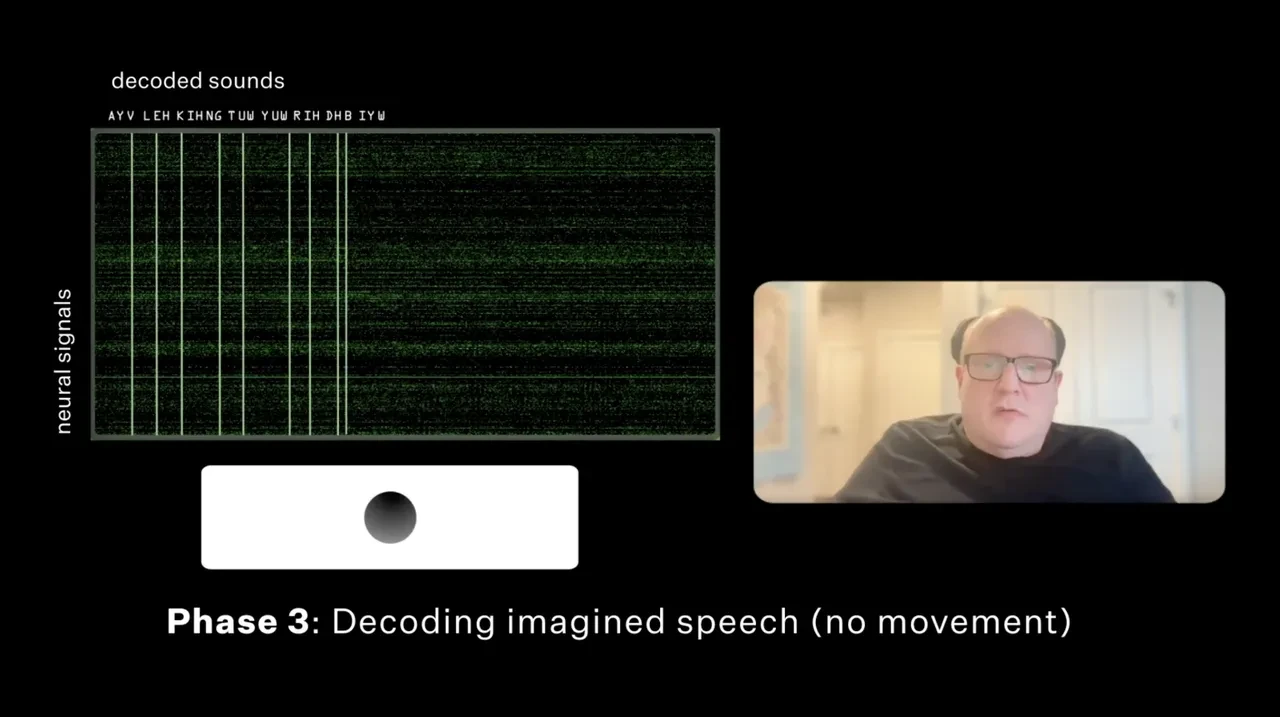 Neuralink beyin çipi takılan bir ALS hastası, ağzını hiç açmadan kendi sesiyle konuştu