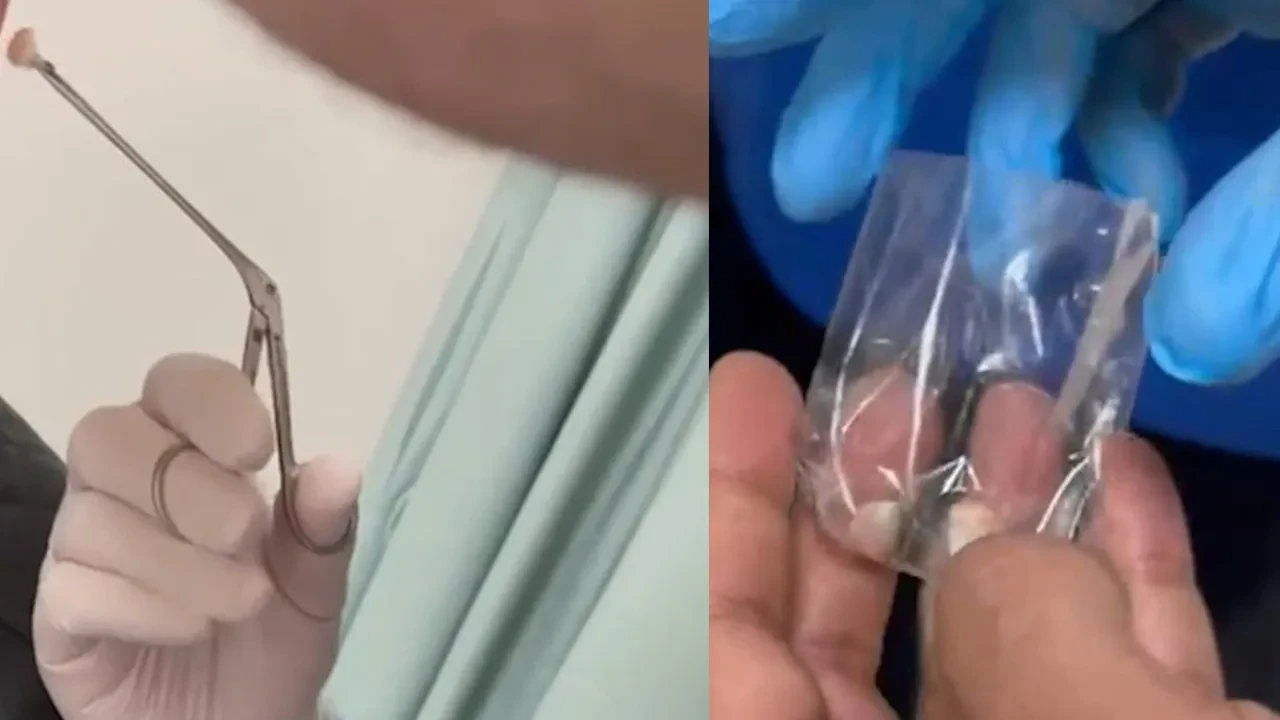 Şeytanın aklına gelmez! Bakın sakladığı uyuşturucu neresinden çıktı