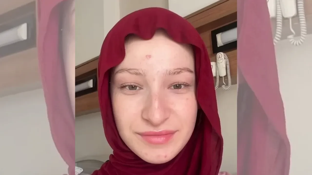 Fenomen Fatma Soydaş’ın estetiksiz hali sosyal medyayı salladı!  Görenler şaşkınlığını gizleyemedi