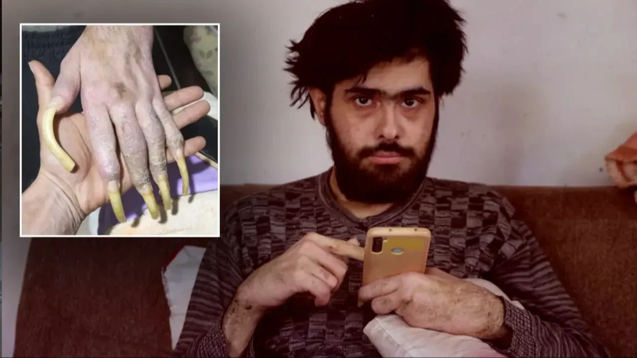 Yıllarca duş almamış, tırnaklarını kesmemişti! Telefon bağımlısı Barış Özbay'ın son hali ortaya çıktı