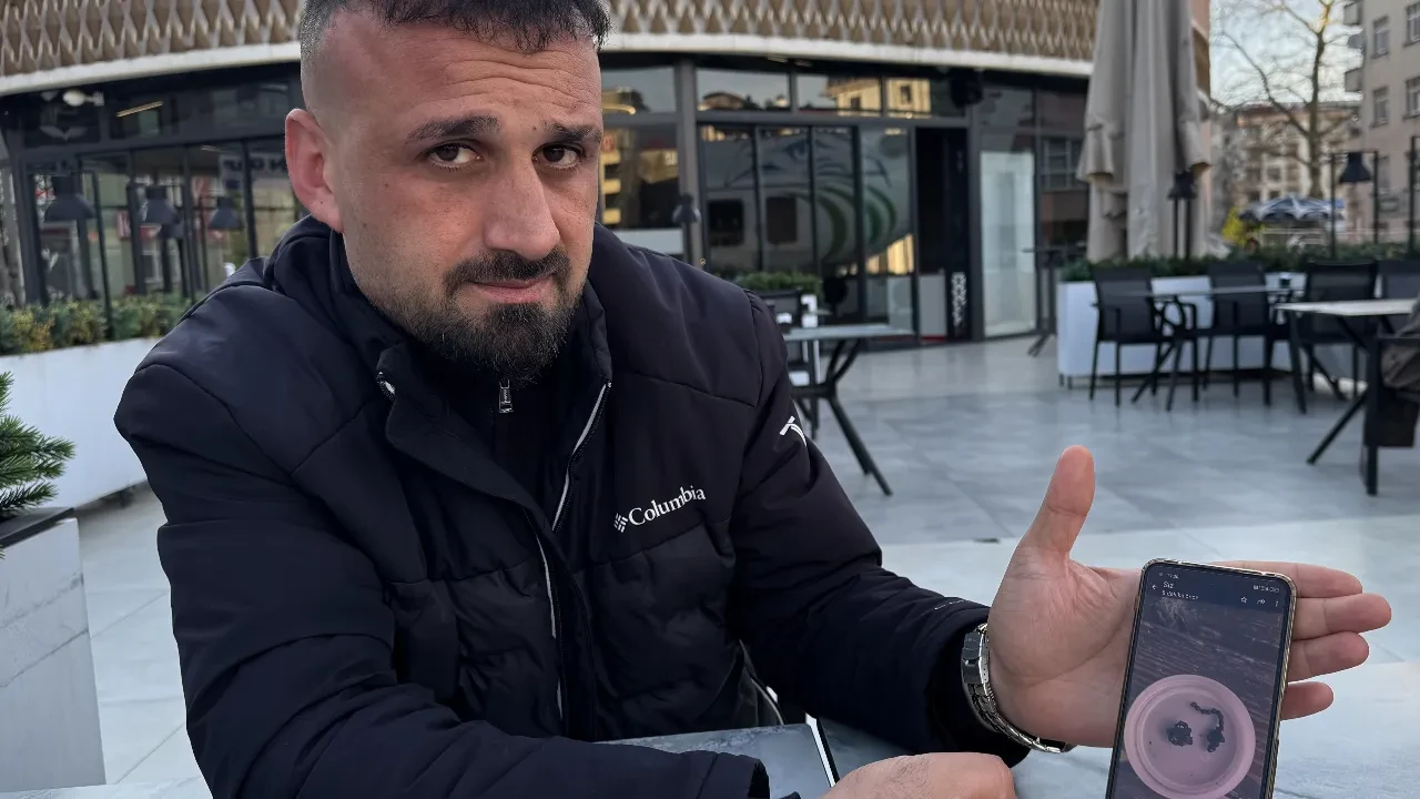 Rize'de 5 yaşındaki çocuğun burnundan tırnak makası parçası çıktı! Özel hastane fark edemedi