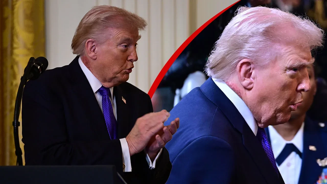 Donald Trump'ın doktorundan açıklama! Boynundaki kızarıklığın sebebi belli oldu