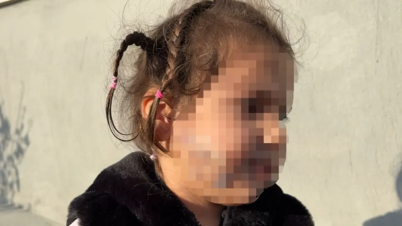 İzmir'de köpek dehşeti kamerada! 3 yaşındaki Ada'nın yüzü pençe ve ısırıkla dolu