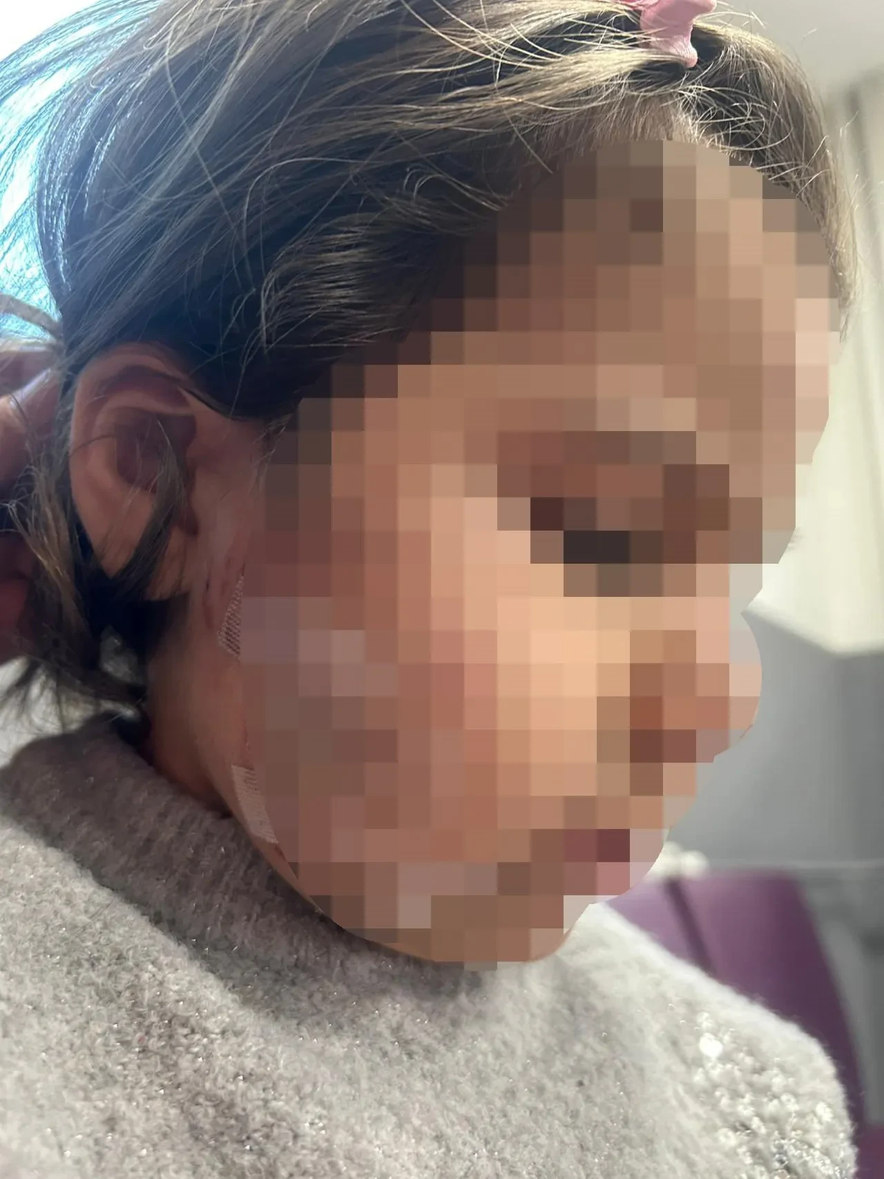 İzmir'de köpek dehşeti kamerada! 3 yaşındaki Ada'nın yüzü pençe ve ısırıkla dolu