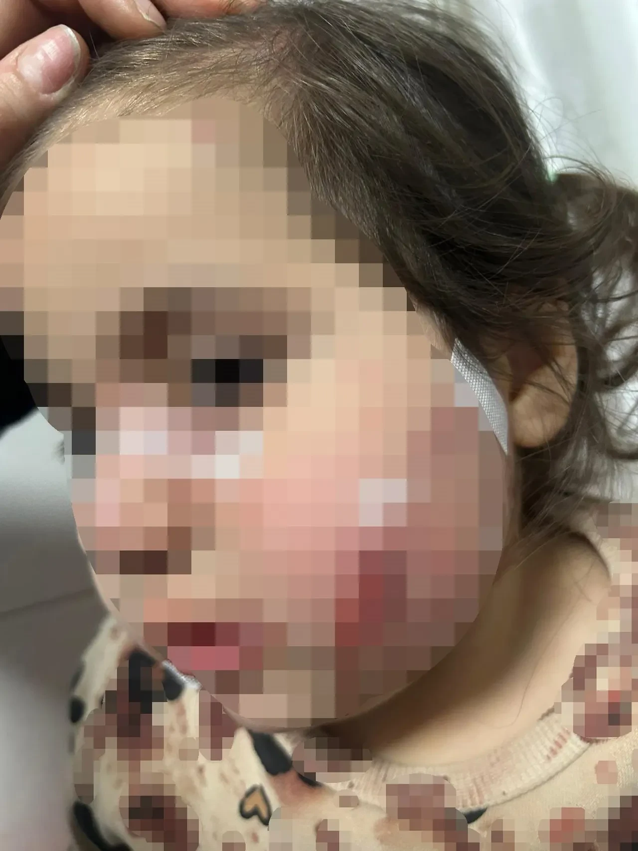 İzmir'de köpek dehşeti kamerada! 3 yaşındaki Ada'nın yüzü pençe ve ısırıkla dolu