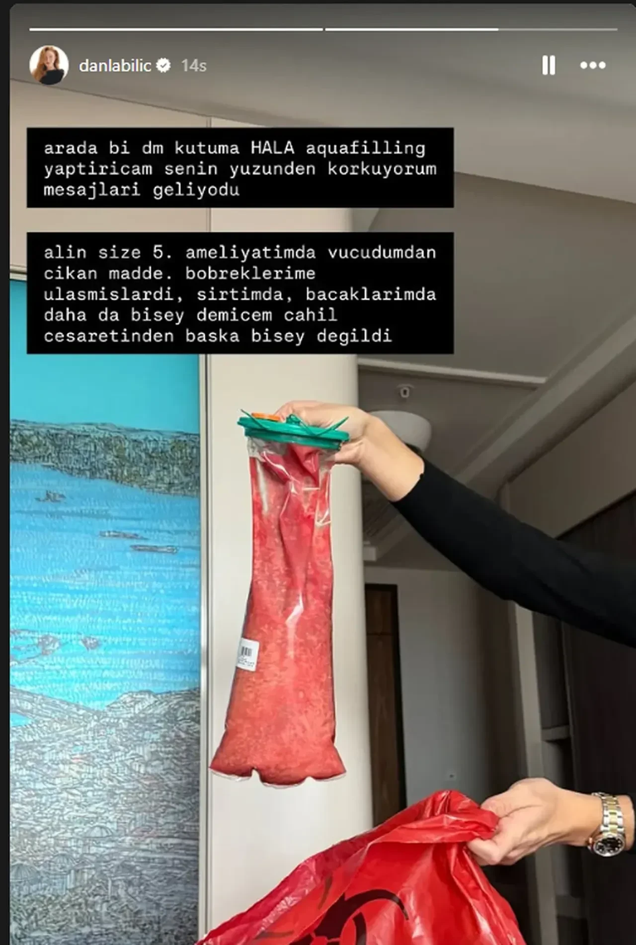 Danla Biliç'in son hali takipçilerini korkuttu! Fenomen sebebini bir bir anlattı 