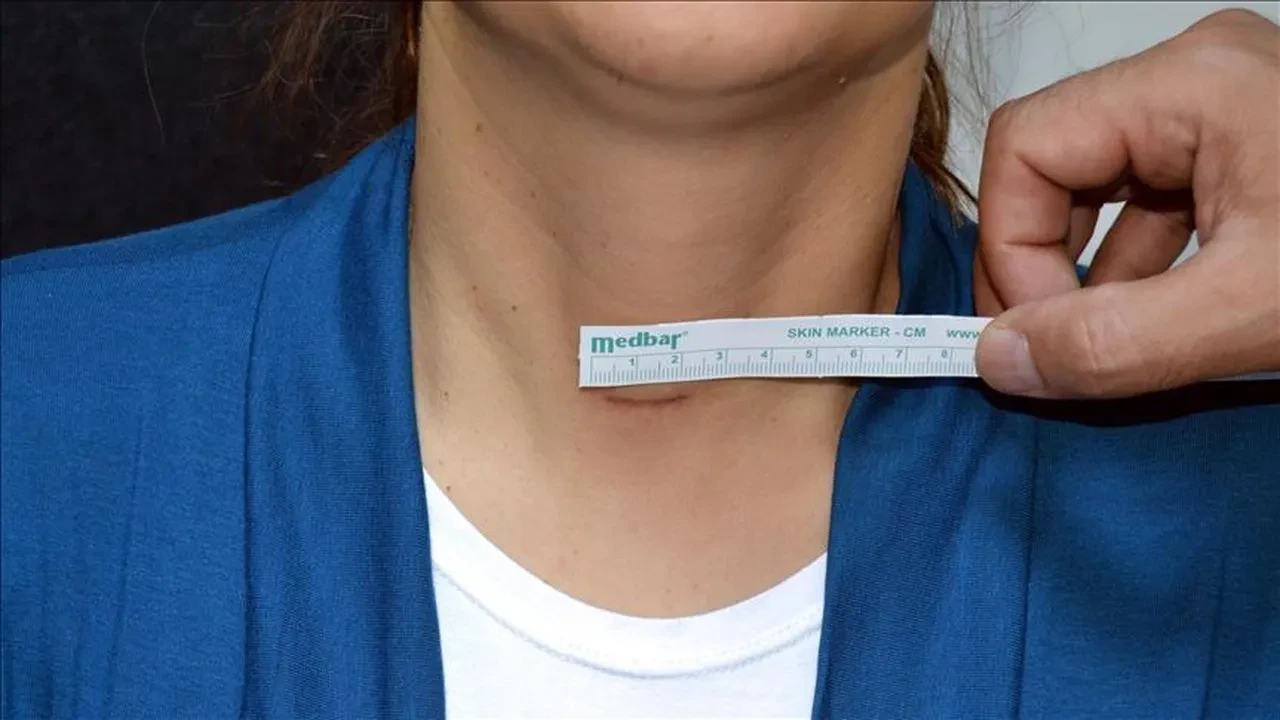 Halsizlik, çarpıntı ve kilo değişimi... Uzman isim Tiroit hastalığının temel belirtilerini açıkladı!