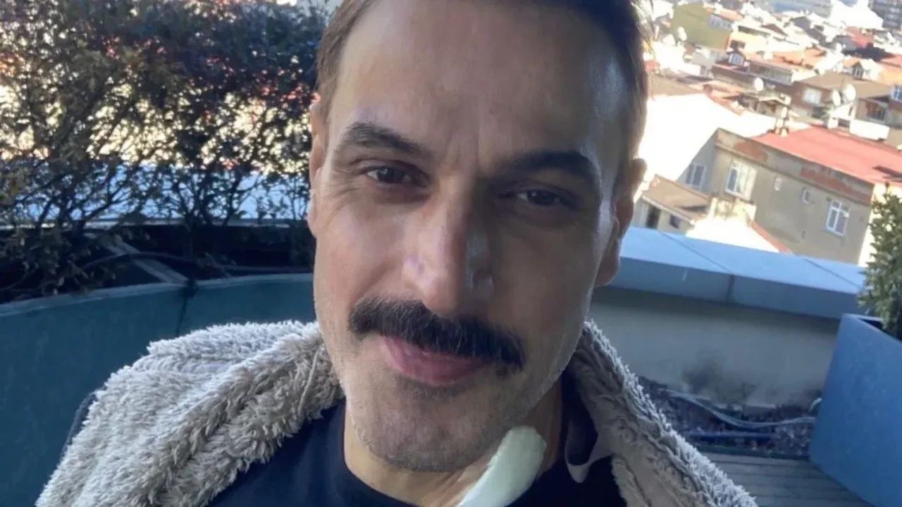 Ufuk Özkan’ın son hali sevenlerini mutlu etti! Güldüren adam geri dönüyor